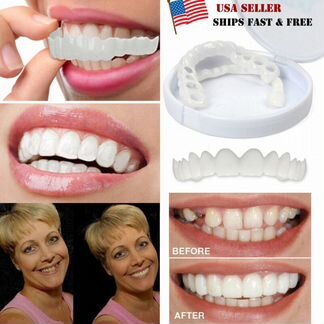 Виниры Snap-On Smile